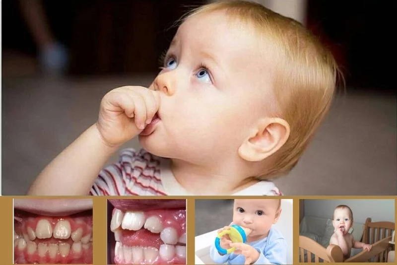 How-To-Fix-Pacifier-Teeth