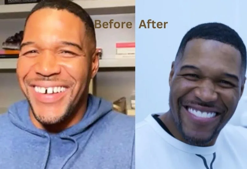 Michael-Strahan-Teeth