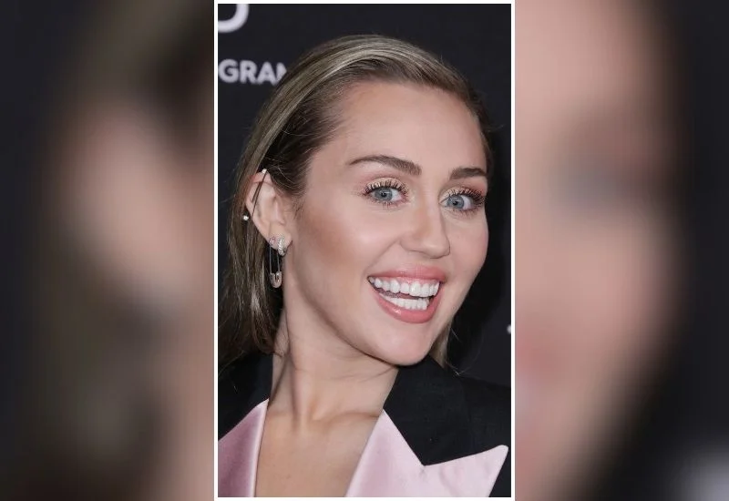 Miley-Cyrus-Veneers