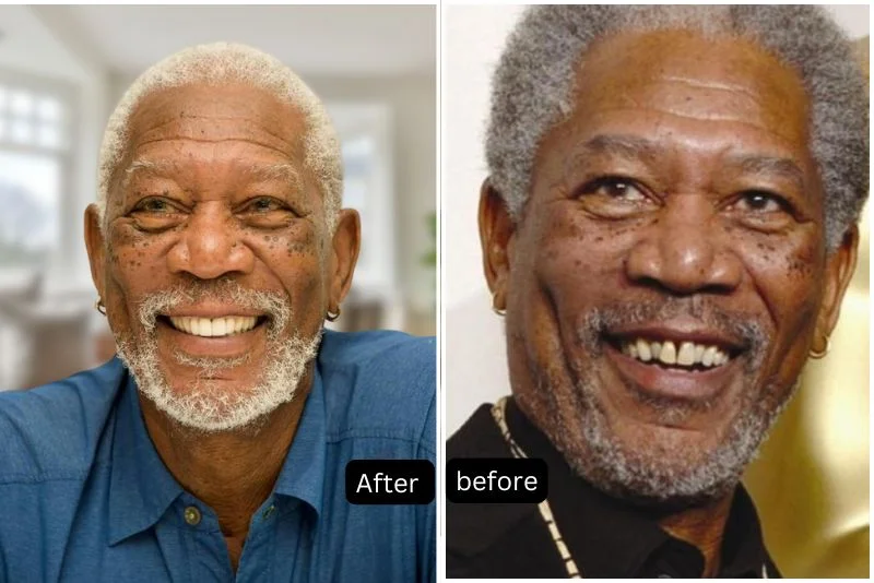 Morgan-Freeman-Veneers-before-after
