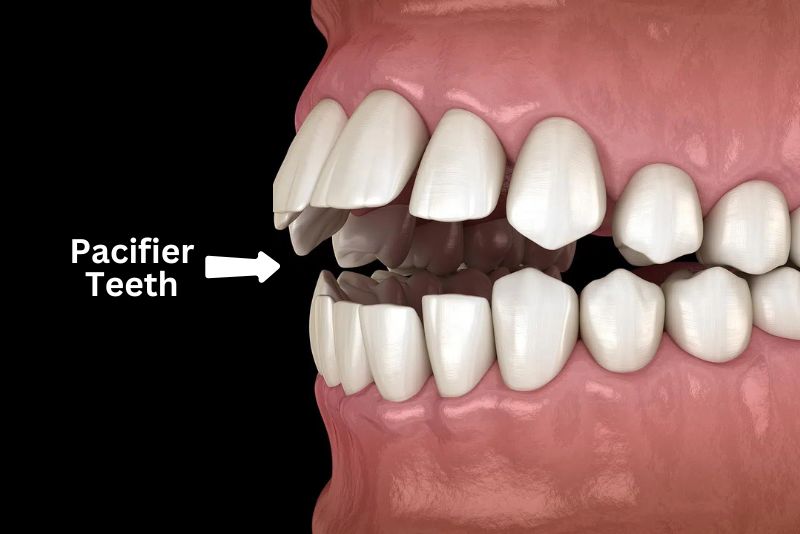 Pacifier Teeth animation