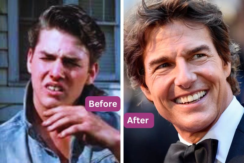 Tom Cruise Teeth Before After