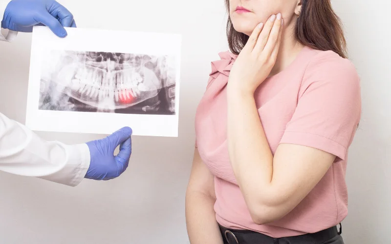 Why Do Wisdom Teeth Often Need To Be Extracted?