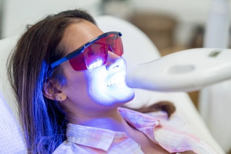 Wisdom-Teeth-Visuals