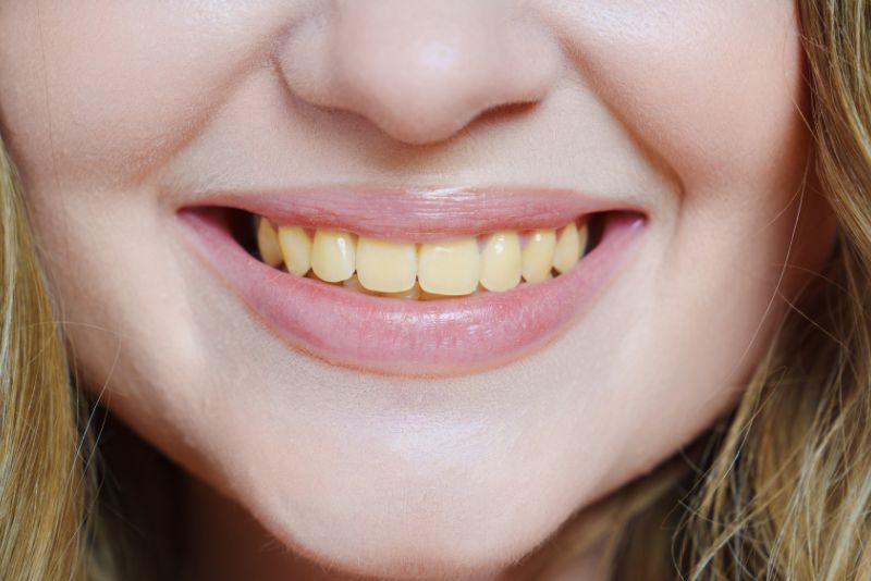 Yellow Teeth Strong