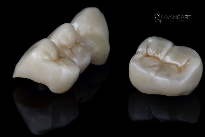 Zicronium-Crowns-Turkey-Final-Shape