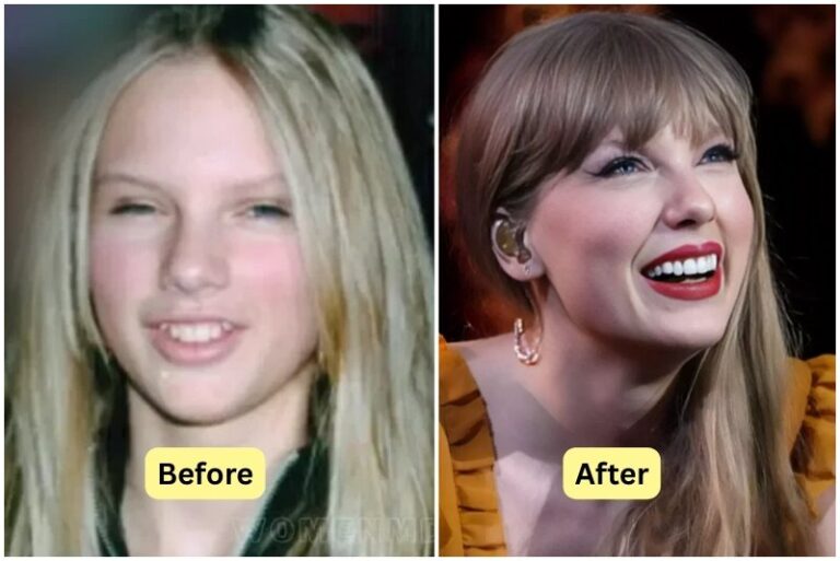 taylor swift teeth