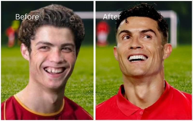 Cristiano Ronaldo Teeth