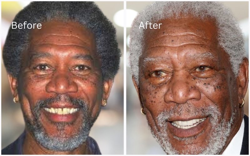 Morgan Freeman’s Teeth