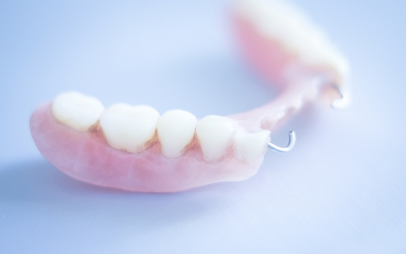 Types of Fake Teeth