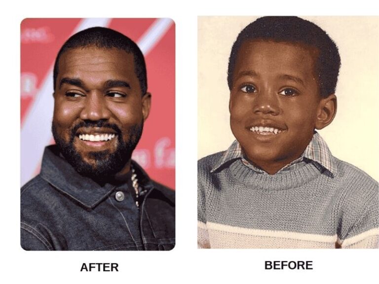 kanye-titanium-teeth