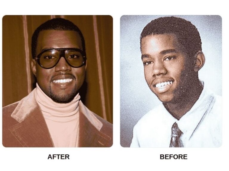 kanye-west-titanium-teeth