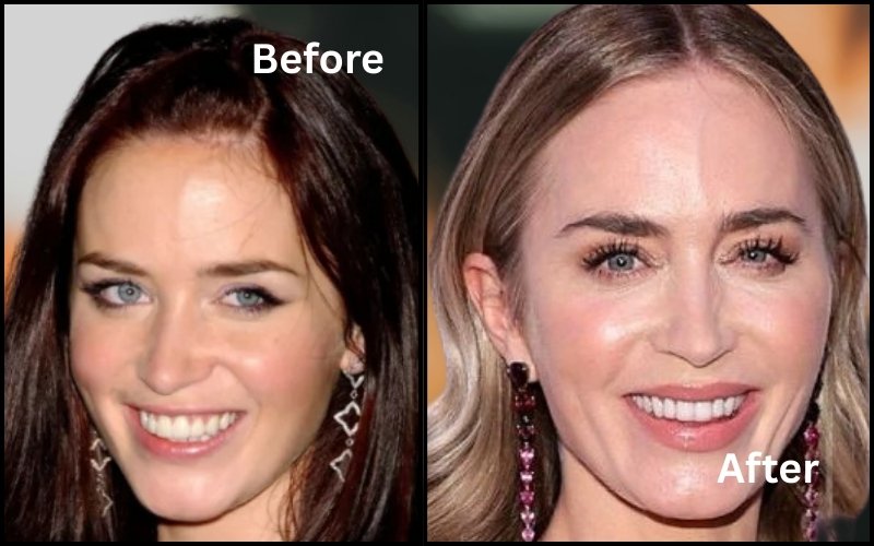 Emily Blunt Before & After