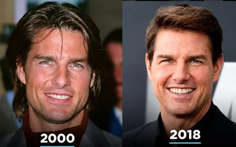 tom-cruise-teeth-before-and-after